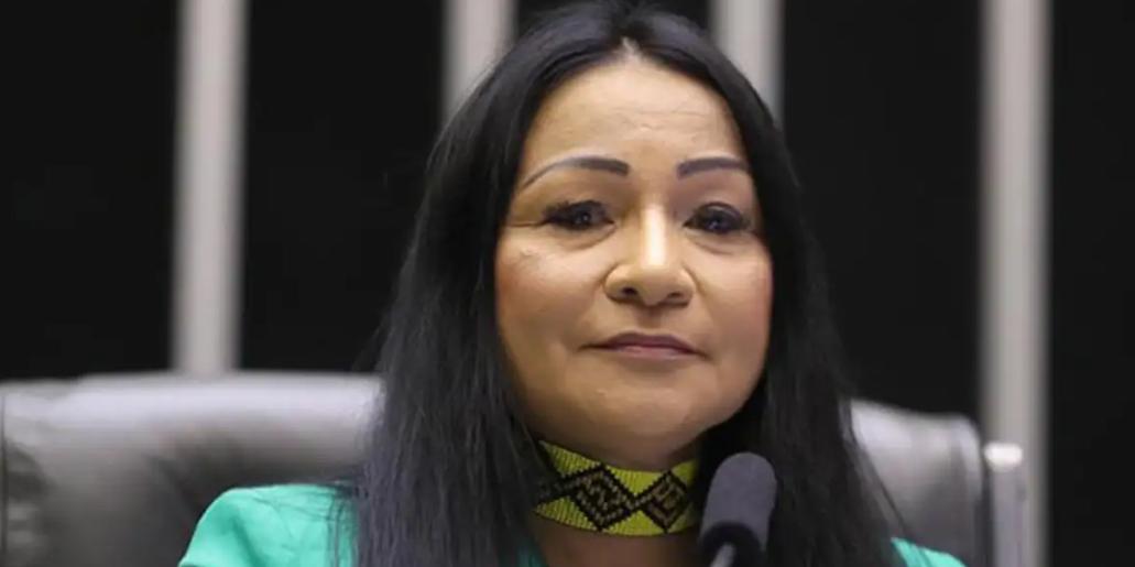 De acordo com a ação, a deputada usou verba pública destinada à campanha eleitoral para realizar uma harmonização em 2022 (Divulgação / Câmara dos Deputados)
