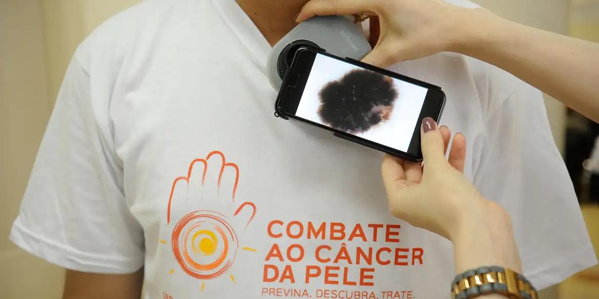 Mutirão atende população hoje, no dia de combate ao câncer de pele (Fernando Frazão / Agência Brasil)