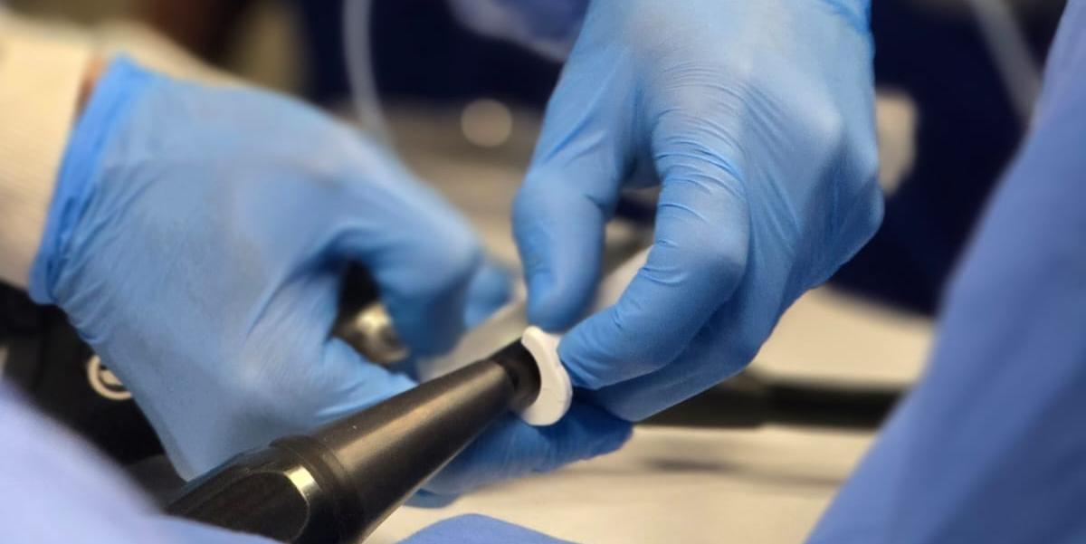 Técnica utiliza o dispositivo Full Thickness Resection Device (FTRD), que consegue extrair toda a área afetada pela lesão, procedimento normalmente feito com cirurgia com o intuito de que não haja um retorno da doença (Hospital Madre Teresa/Divulgação)