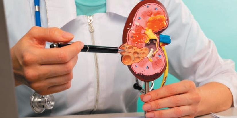 A Doença Renal Crônica (DRC) é uma condição grave e assintomática que afeta a função dos rins, e seu tratamento, muitas vezes, envolve hemodiálise ou transplante (Freepik/Reprodução)