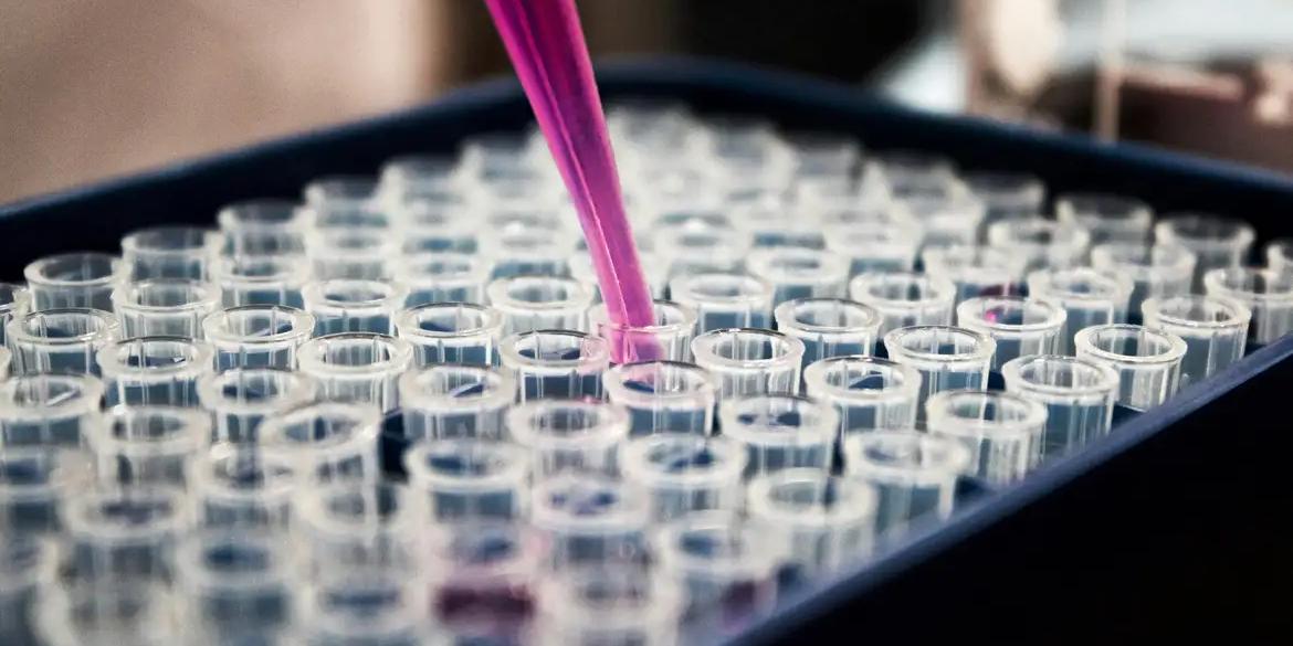 (Louis Reed/ Unsplash)