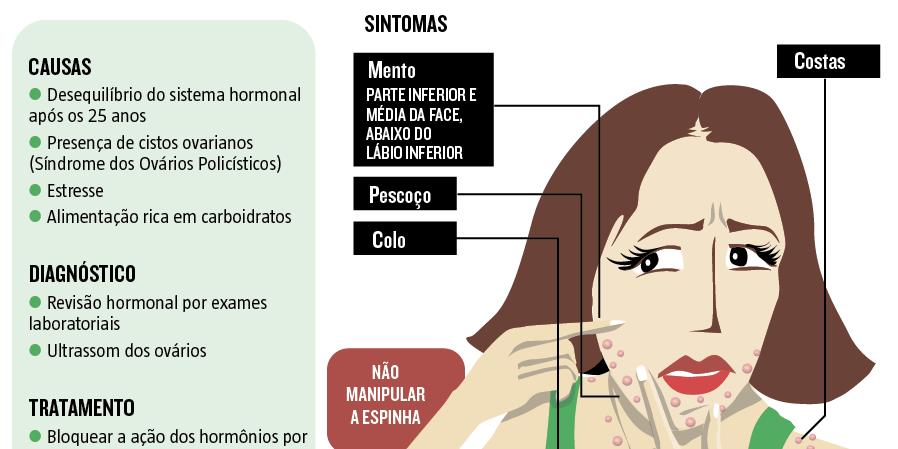  (Editoria de Arte)