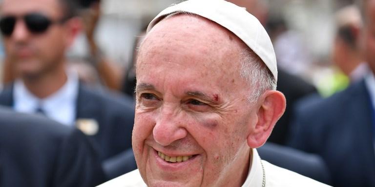  (ALBERTO PIZZOLI / AFP)