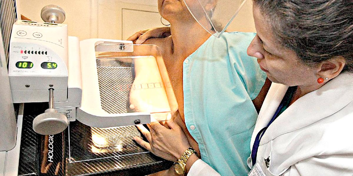 Inca estima quase 74 mil novos casos de câncer de mama por ano no Brasil entre 2023 e 2025 e 18 mil mortes (Lucas Prates/ ARQUIVO HOJE EM DIA)