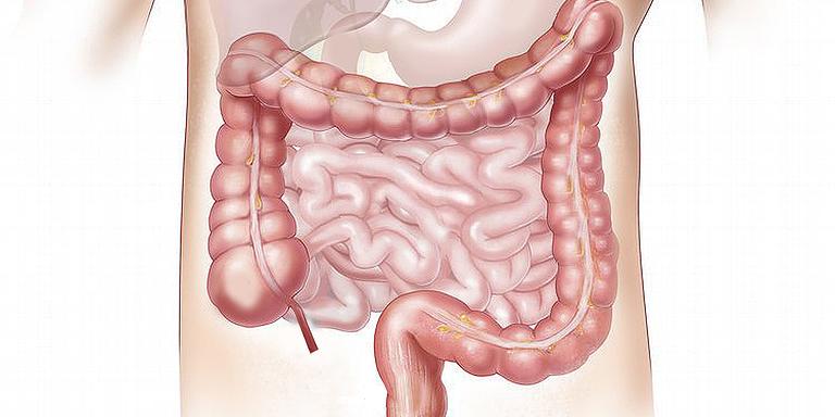 Brasil registrou 212.026 casos de doenças inflamatórias intestinais de 2012 a 2020 (Divulgação)