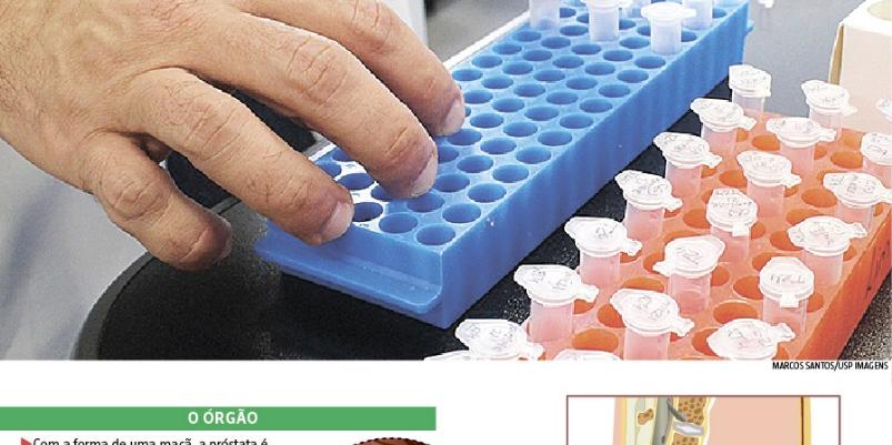 (Edição de Arte)