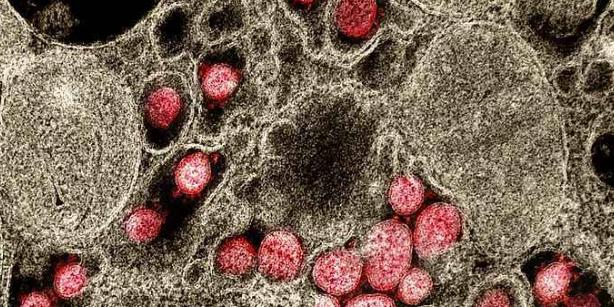 (National Institute of Allergy and Infectious Diseases/Reprodução)