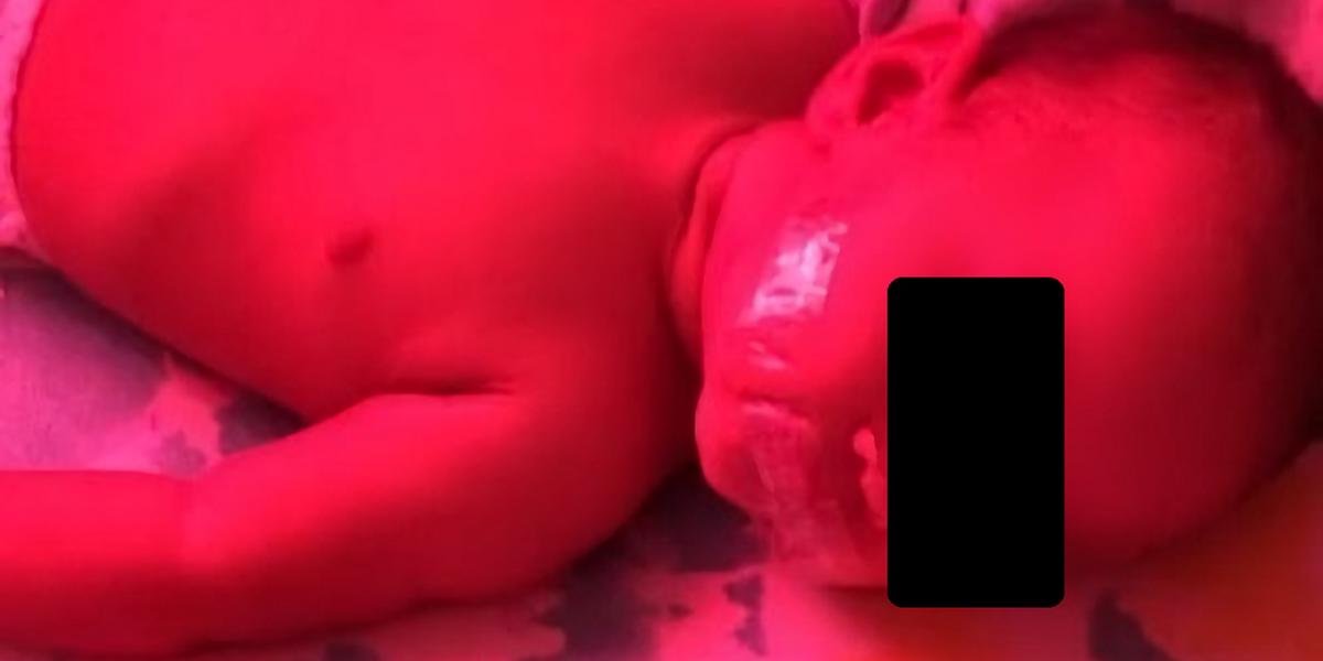 Bebê de 6 meses teve a boca fechada com fita adesiva para não chorar (Facebook / Reprodução)