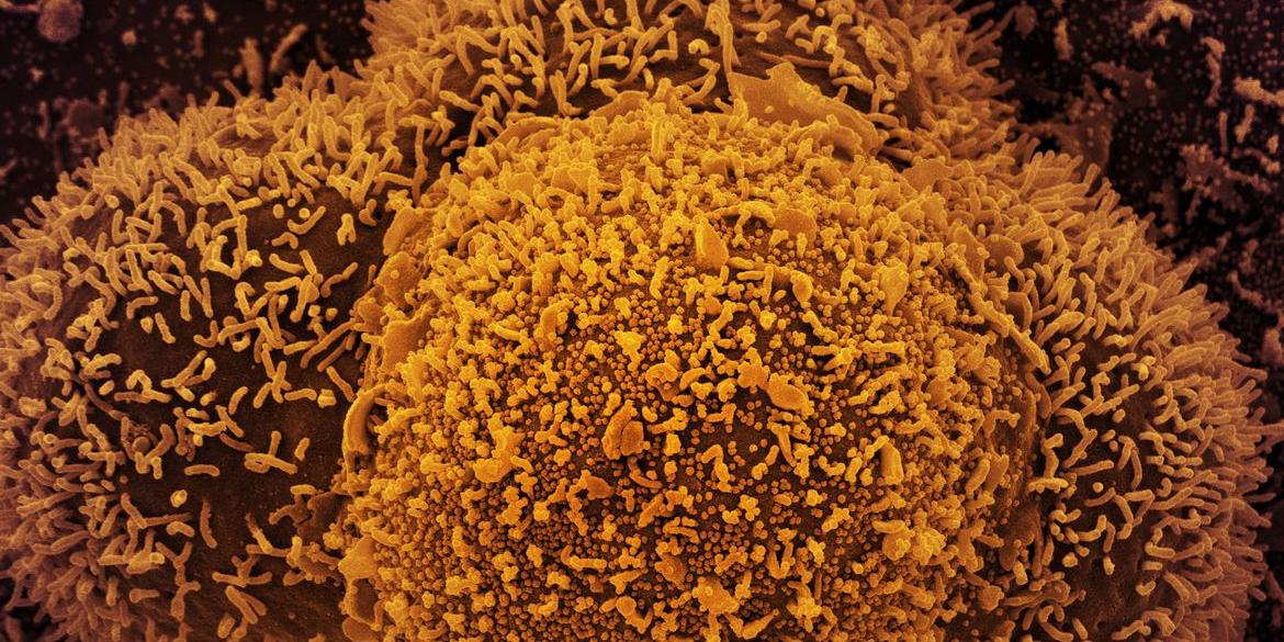 (Reprodução / National Institute of Allergy and Infectious Diseases (USA))