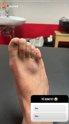 Jogador mostrou inchaço no pé direito em sua rede social (Reprodução/Instagram)