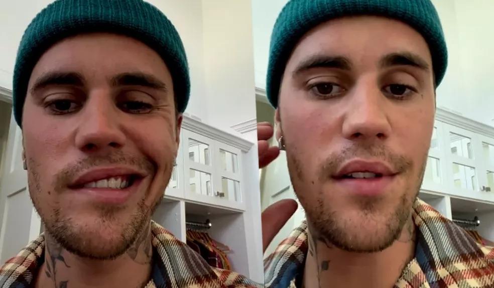 Justin Bieber revelou para os fãs que está com o lado esquerdo do rosto paralisado devido à síndrome de Ramsay Hunt (Instagram / justinbieber / Reprodução)
