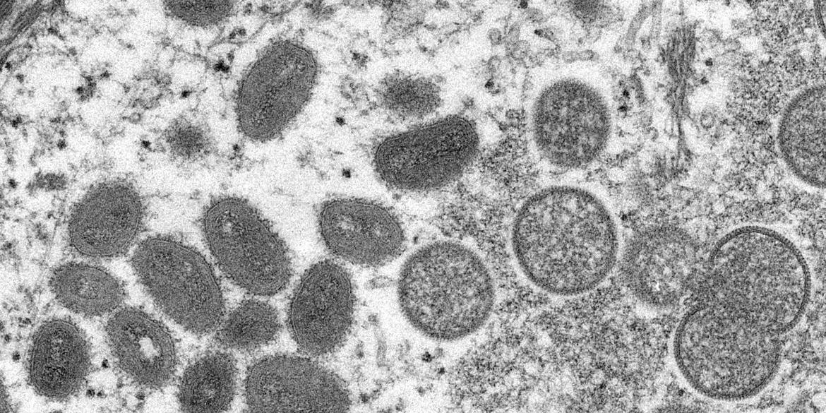 (Cynthia S. Goldsmith / Centers for Disease Control and Prevention / Divulgação)