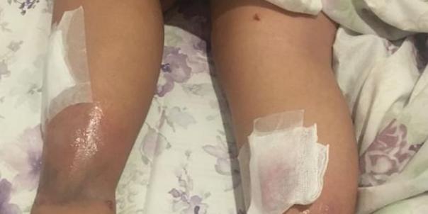Menina de 11 anos fica ferida após PM soltar bomba de gás lacrimogêneo no Mineirão (Reprodução / Redes Sociais)