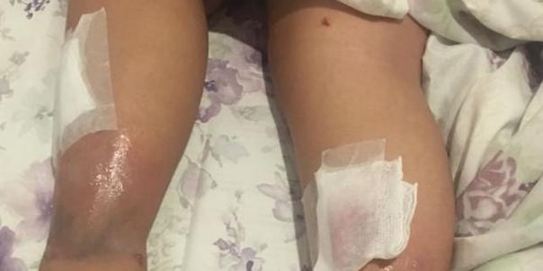 Menina de 11 anos fica ferida após PM soltar bomba de gás lacrimogêneo no Mineirão  (Reprodução / Redes Sociais)