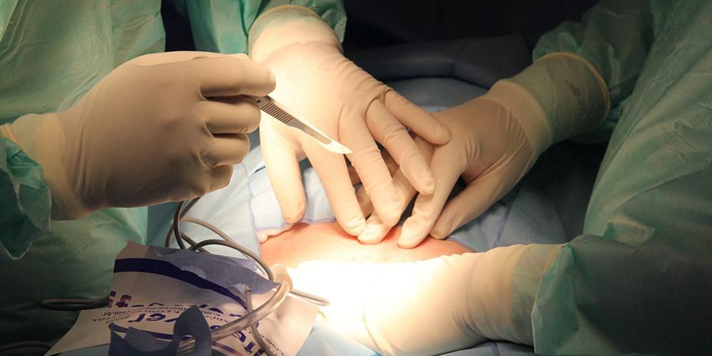 Uma mulher receberá indenização de R$ 30 mil por danos morais e R$ 10 mil por danos estéticos devido a negligência médica por objetos deixados em seu corpo durante cesariana, decidiu em segunda instância o TJMG (foto ilustrativa / TJMG / Divulgação)