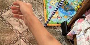 Mulher postou imagens de machucado que teriam sido provocados pelo integrante da torcida (Reprodução redes sociais)